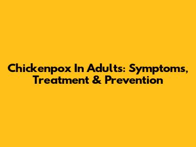 Chickenpox In Adults: Symptoms, Treatment & Prevention