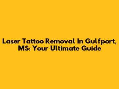 Laser Tattoo Removal In Gulfport, MS: Your Ultimate Guide