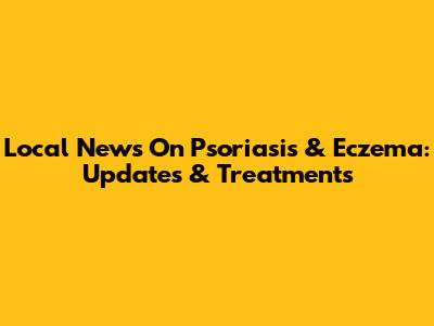 Local News On Psoriasis & Eczema: Updates & Treatments