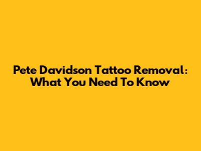 Pete Davidson Tattoo Removal: What You Need To Know