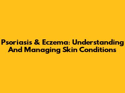 Psoriasis & Eczema: Understanding And Managing Skin Conditions