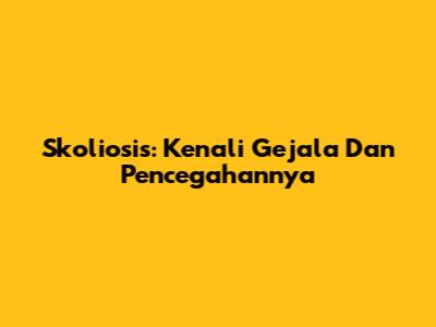 Skoliosis: Kenali Gejala Dan Pencegahannya